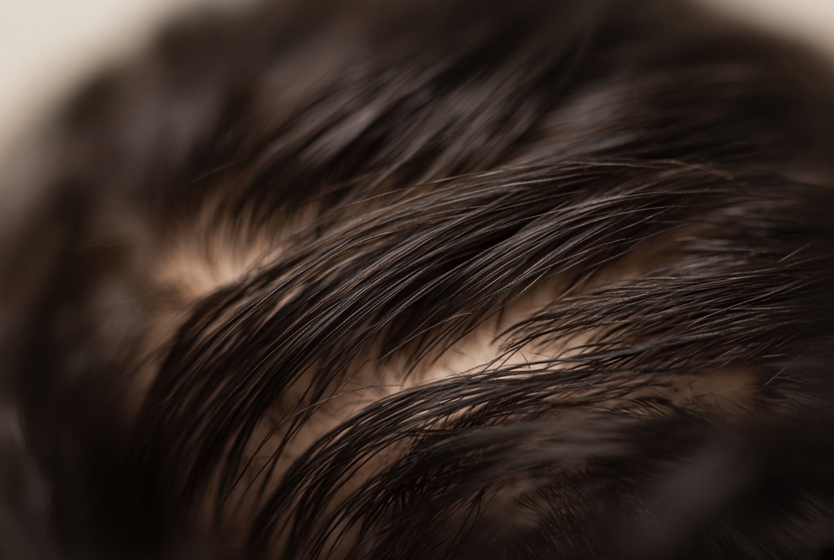 Close-up of scalp hair shafts in studio light